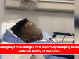 Young boys face charges after reportedly dumping boiling water on 'buddy' at sleepover.